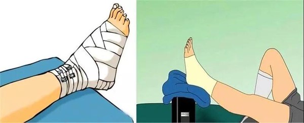 绑绷带.jpg