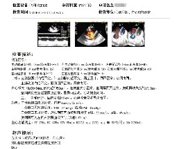 ebb3c8cb36f30dc501774d436c5a388c.png