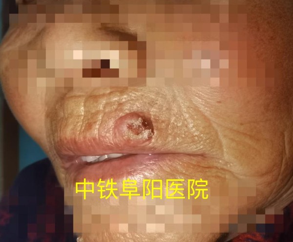 图片 1.png
