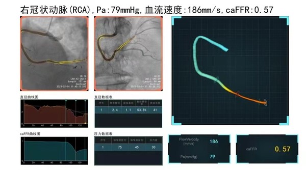 图片 2.png