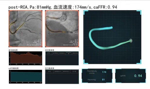 图片 4.png