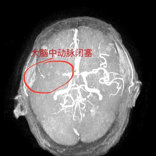 图片 1.png