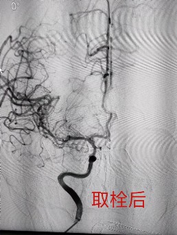 图片 3.png