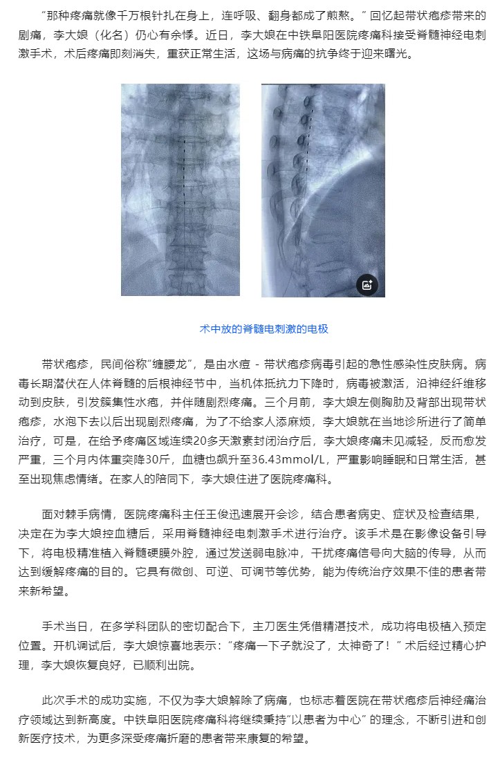 “缠腰龙” 剧痛缠身，脊髓神经电刺激术带来新生.jpg