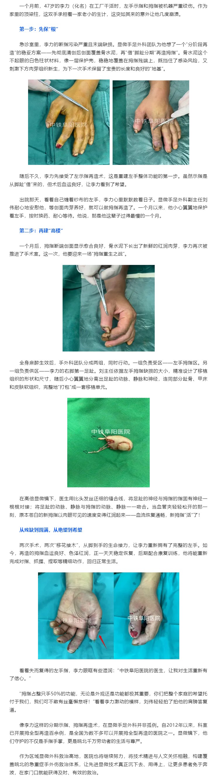 &ldquo;借&rdquo;趾为指，重燃希望.jpg