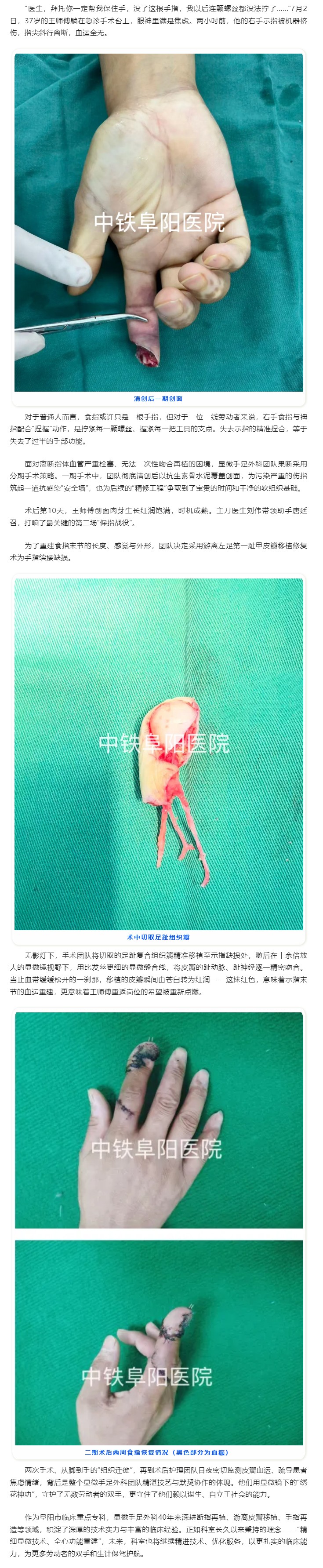 足趾移植&ldquo;再造&rdquo;手指，中铁阜阳医院为劳动者重塑&ldquo;捏握&rdquo;之力.jpg
