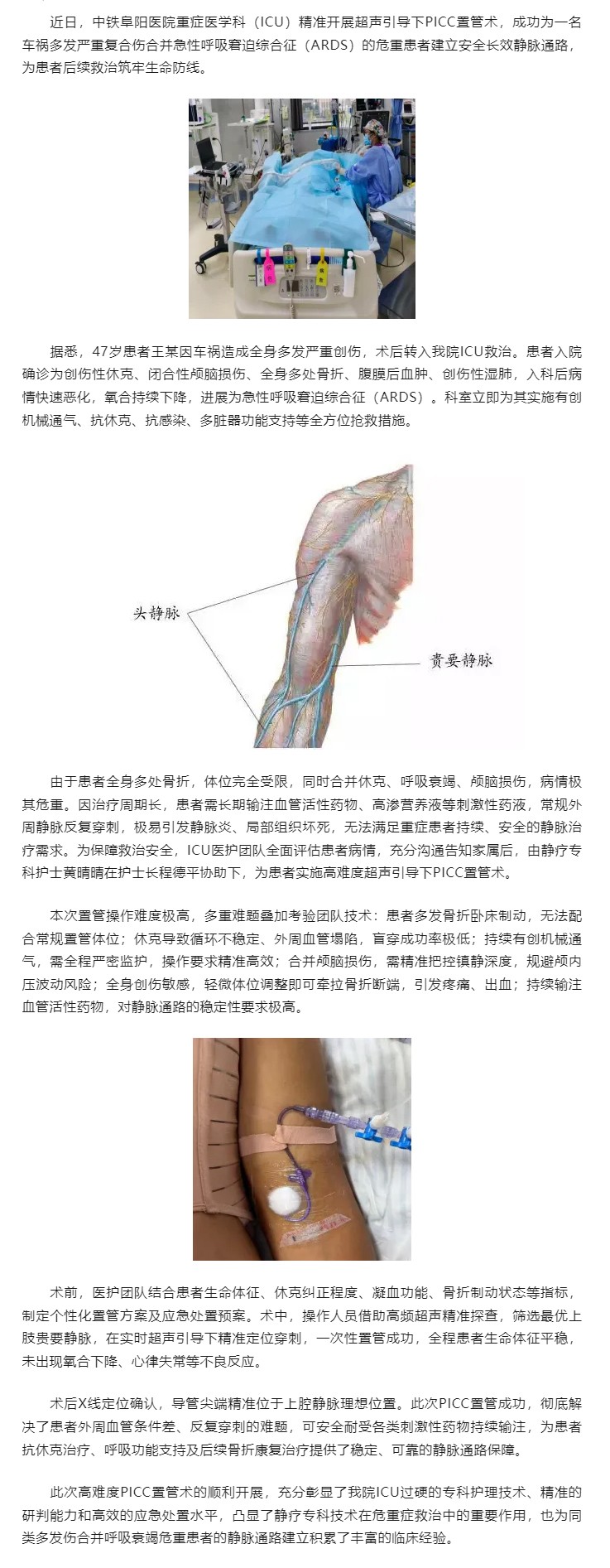 一根PICC导管，架通生命&ldquo;桥梁&rdquo;&mdash;&mdash;我院ICU成功为多发严重复合伤合并ARDS危重患者实施PICC.jpg